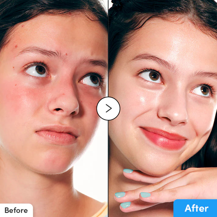 سيروم "Hyaltoin Flooding Serum" من علامة "Eqqualberry" الكورية للعناية بالبشرة