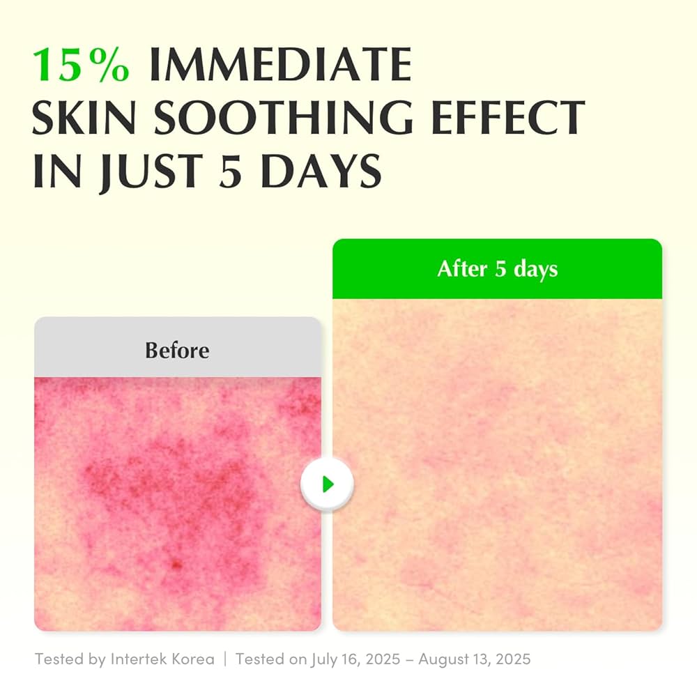 سيروم EQQUAL BERRY GREEN AID ALOE PDRN Calming Serum